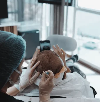 Unterschiede DHI Methode und FUE Methode: