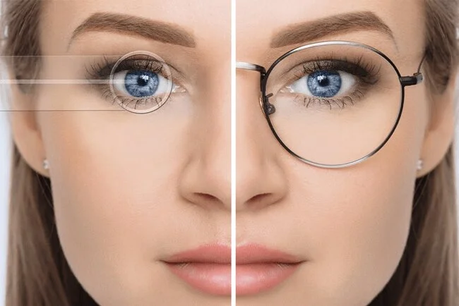 Augenlaser Image bei Merhabeauty