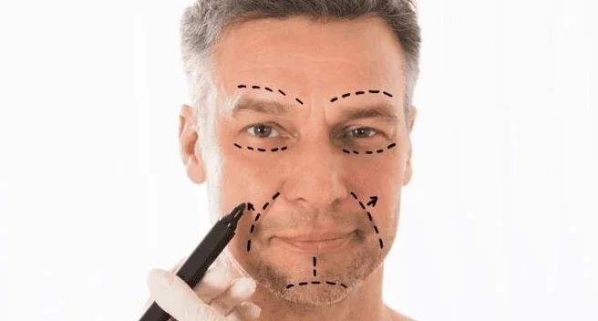 Facelifting bei MerhaBeauty in der Türkei