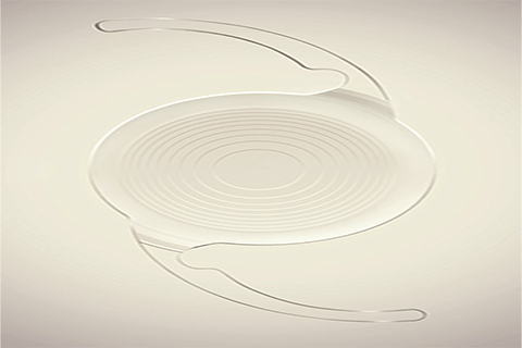 Trifokallinsen bei Merhabeauty 1