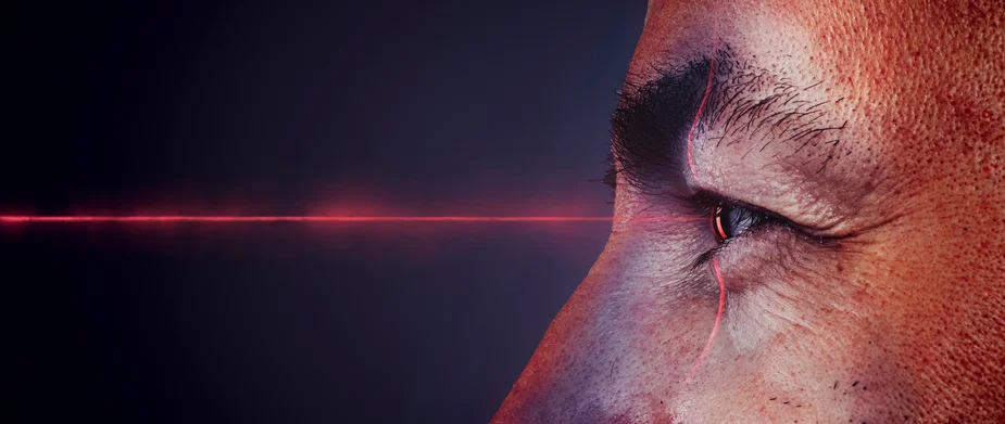 Augenlaser Türkei Merhabeauty